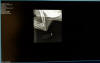Leftelbow_small